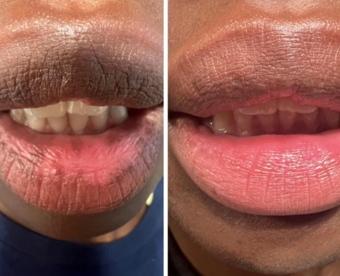 Mavella™ Crystal Hydration Lip Mask