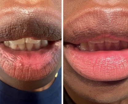 Mavella™ Crystal Hydration Lip Mask