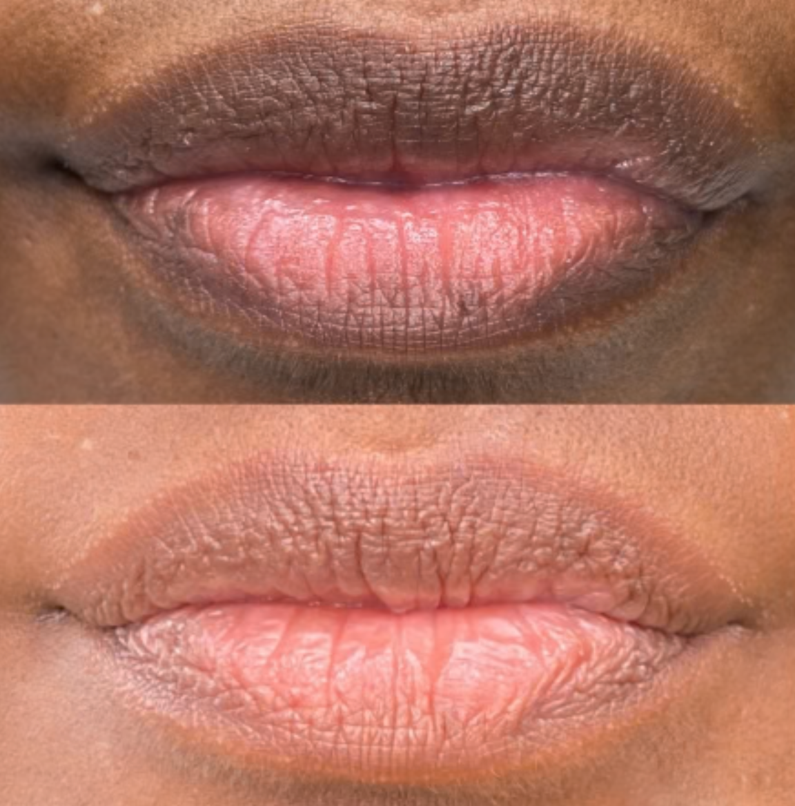 Mavella™ Crystal Hydration Lip Mask