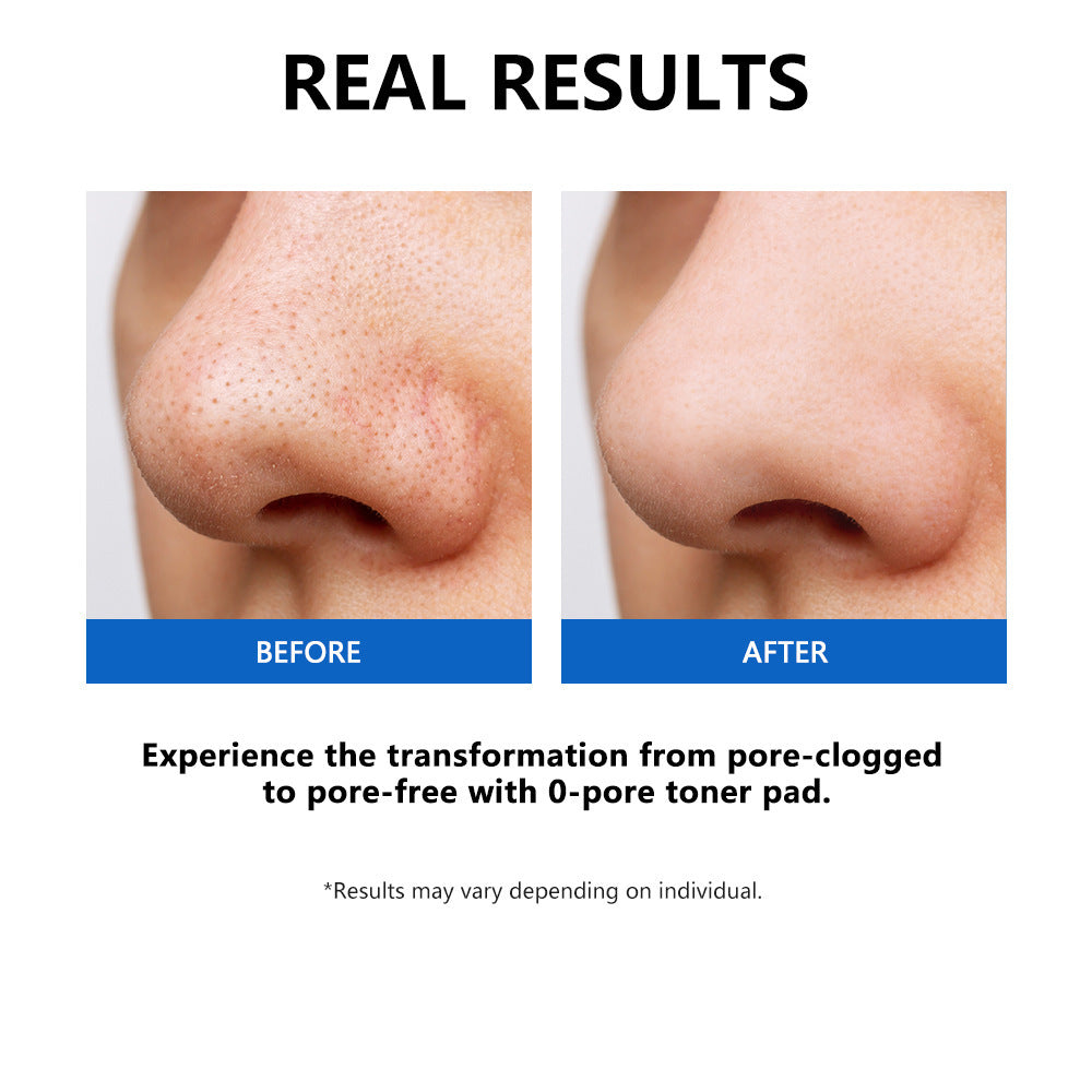 Mavella™ Zero Pore Pads 2.0, Dual-Textured Facial Toner Pads for Exfoliation