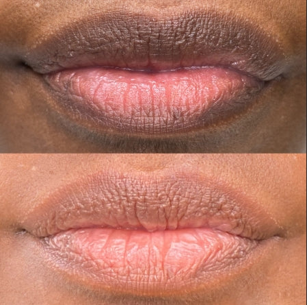 Mavella™ Dark lips Cream